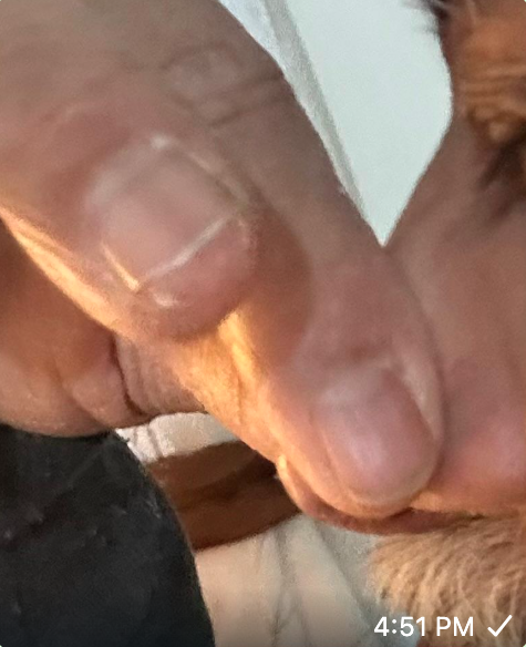 ٽِٽَ ڦُوس ڏيڻ/ هوا خارج ڪرڻ